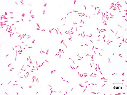 Pseudomonas Aeruginosa Gram Stain, Culture .